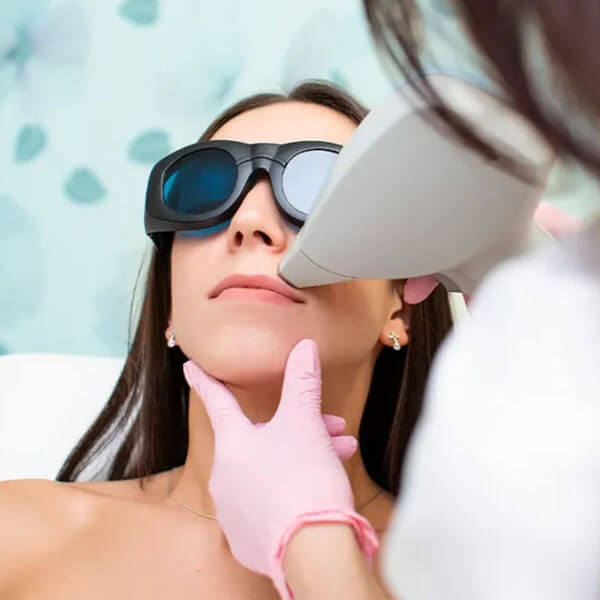 laser-hair-removal